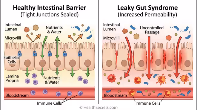 Healthy gut barrier vs leaky gut comparison showing intact versus damaged tight junctions
