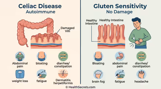 Infographic comparing celiac disease autoimmune intestinal damage with non-celiac gluten sensitivity showing key differences in immune response