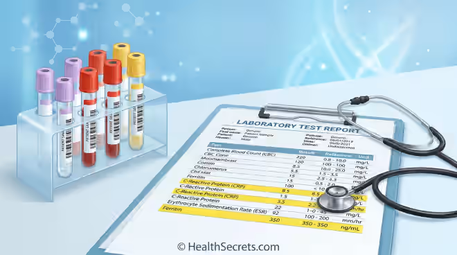 Blood test vials and laboratory report showing inflammation markers CRP ESR and ferritin results