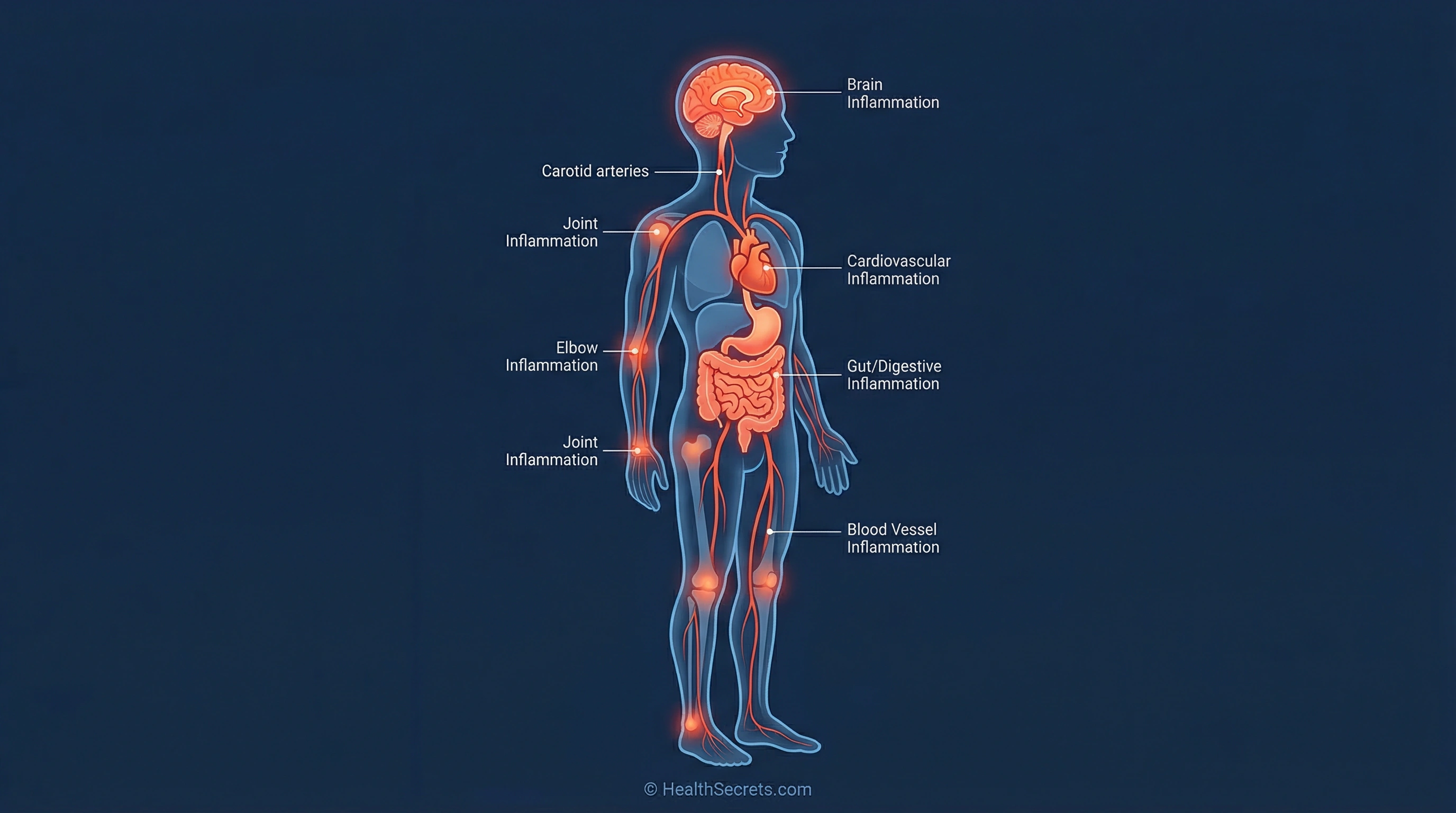 Medical illustration showing chronic inflammation affecting multiple organ systems including heart, brain, gut, and joints