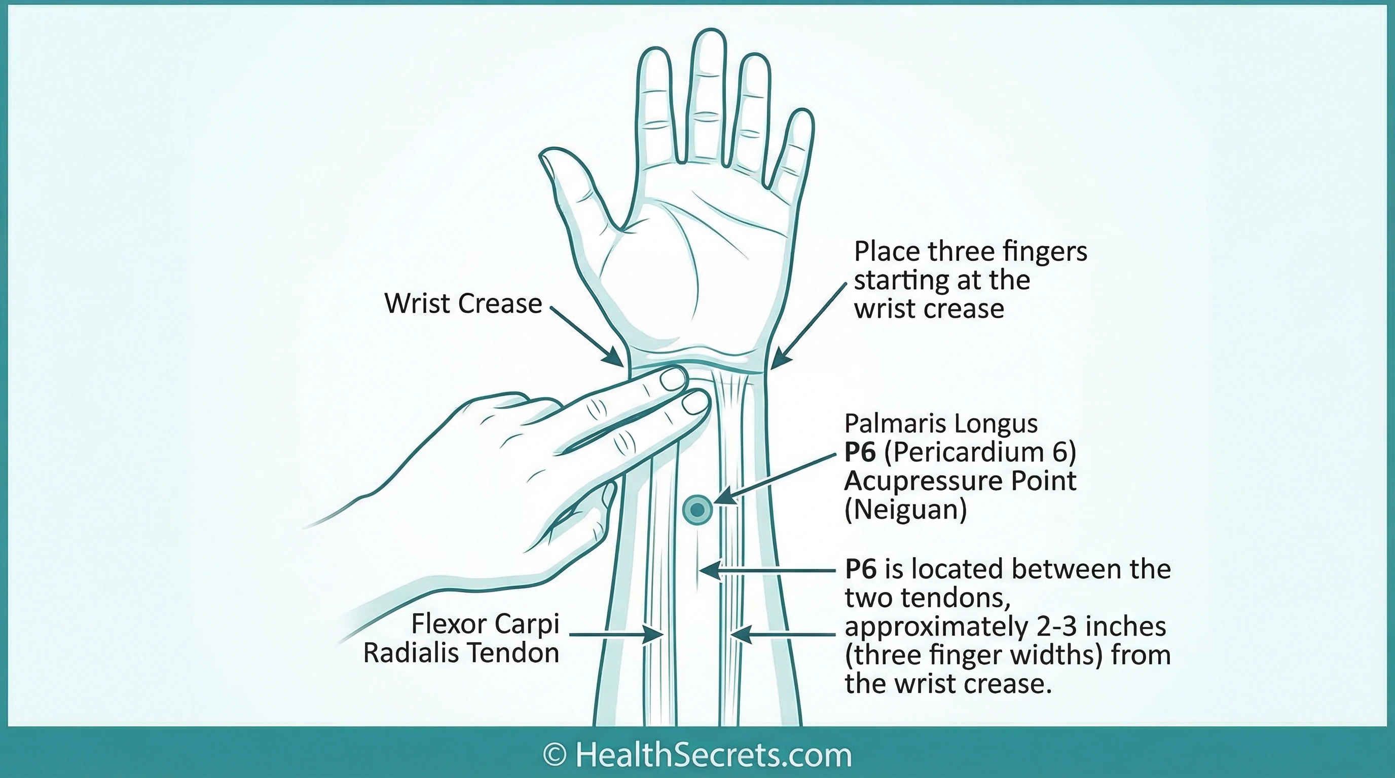 Diagram showing how to locate the P6 Nei Guan acupressure point on the inner wrist for nausea relief