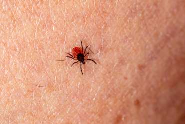 What Causes Lyme Disease Symptoms?