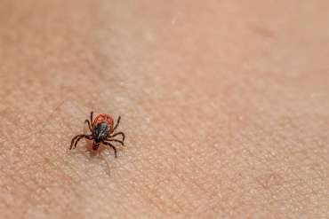 From Ticks to Symptoms: Everything You Need to Know About Lyme Disease