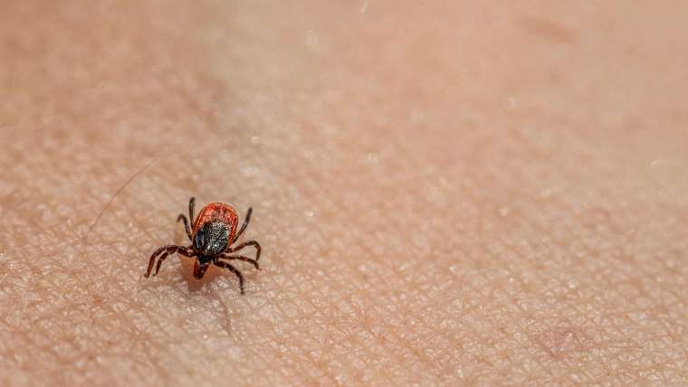 From Ticks to Symptoms: Everything You Need to Know About Lyme Disease